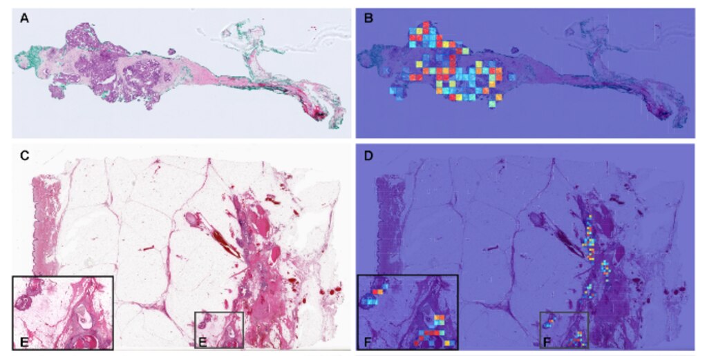 癌の病理組織アトラスATLAS OF CANCER HISTOPATHOLOGY