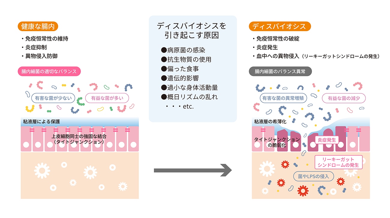 ディスバイオシス（dysbiosis）