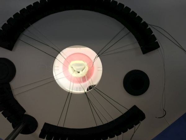 MICS MX1 कार्यान्वयन उदाहरण