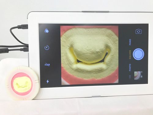 MICSMX1案例分析