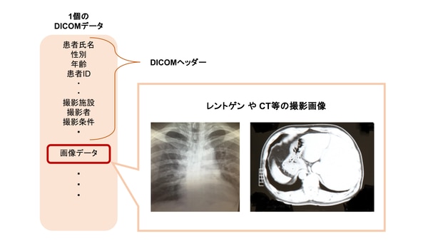 DICOMデータのイメージ