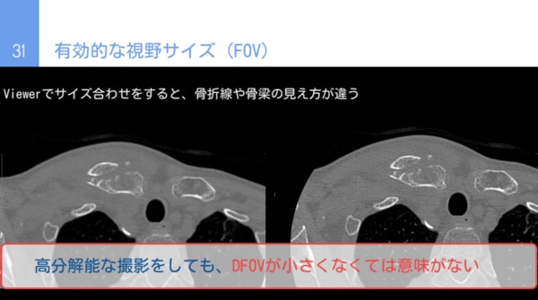 セミナー資料の抜粋画像_有効な視野サイズ（FOV）