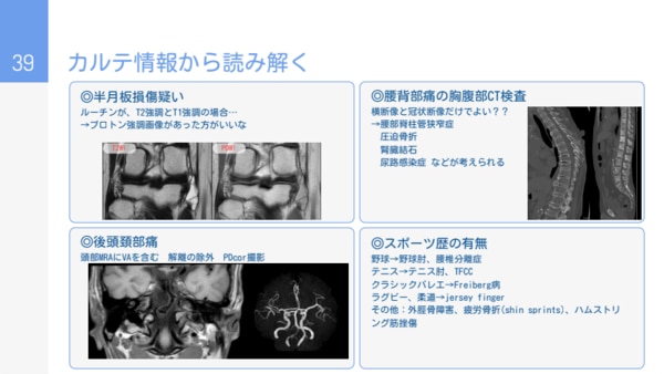 セミナー資料の抜粋画像_カルテ情報から読み解く