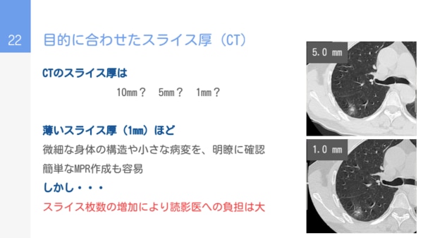 セミナー資料の抜粋画像_目的に合わせたスライス厚（MRI）