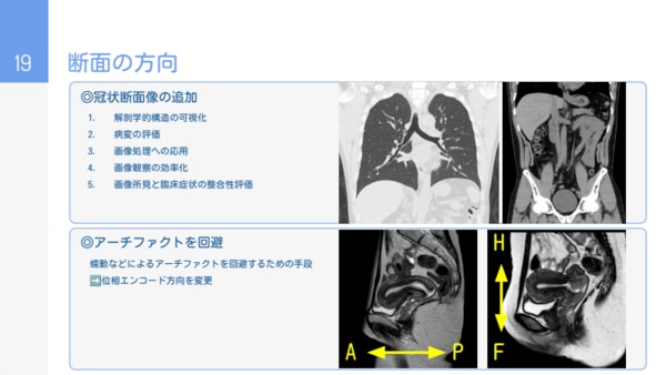 セミナー資料の抜粋画像_断面の方向