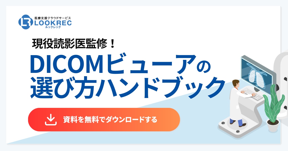 DICOMビューアの選び方ハンドブックホワイトペーパーダウンロードボタン