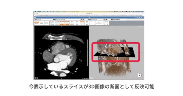 3Dビューア機能_スライスライン