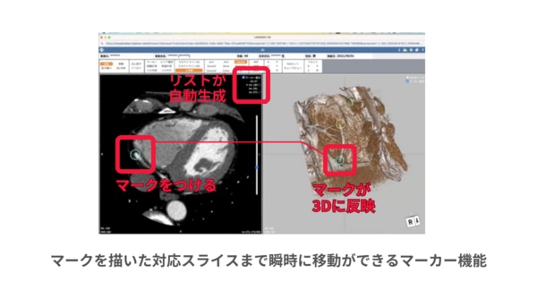 3Dビューア機能_マーカー機能