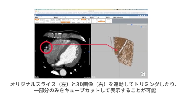 3Dビューア機能_VOIカット/キューブビュー機能