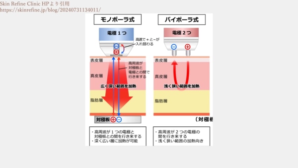 設定の「深さ」に関する議論：浅打ちvs深打ち
