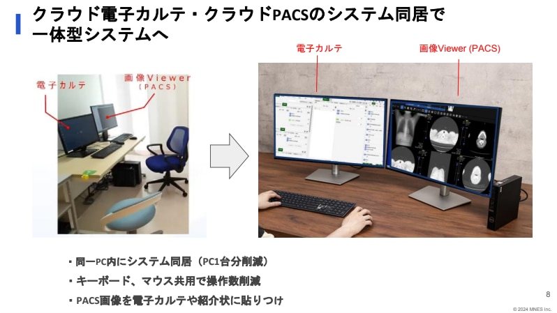 クラウドの電子カルテとPACSを一体型システムへ_セミナー資料