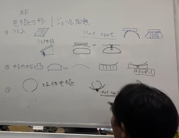 電極形状