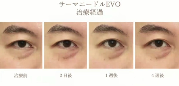 治療経過