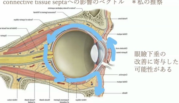 connective tissue septaへの影響のベクトル