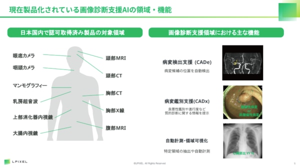 LPIXEL共済セミナーレポート_画像診断支援AIの領域と機能