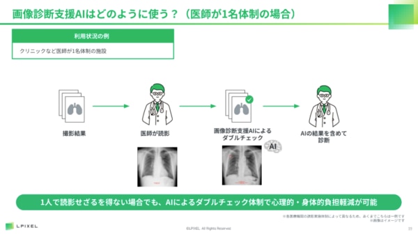 LPIXEL共済セミナーレポート_画像診断支援AIの活用例