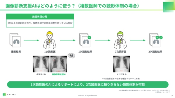 LPIXEL共済セミナーレポート_画像診断支援AIの活用例2