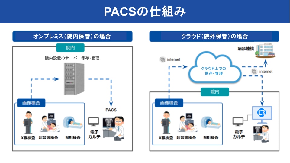 PACSの仕組み