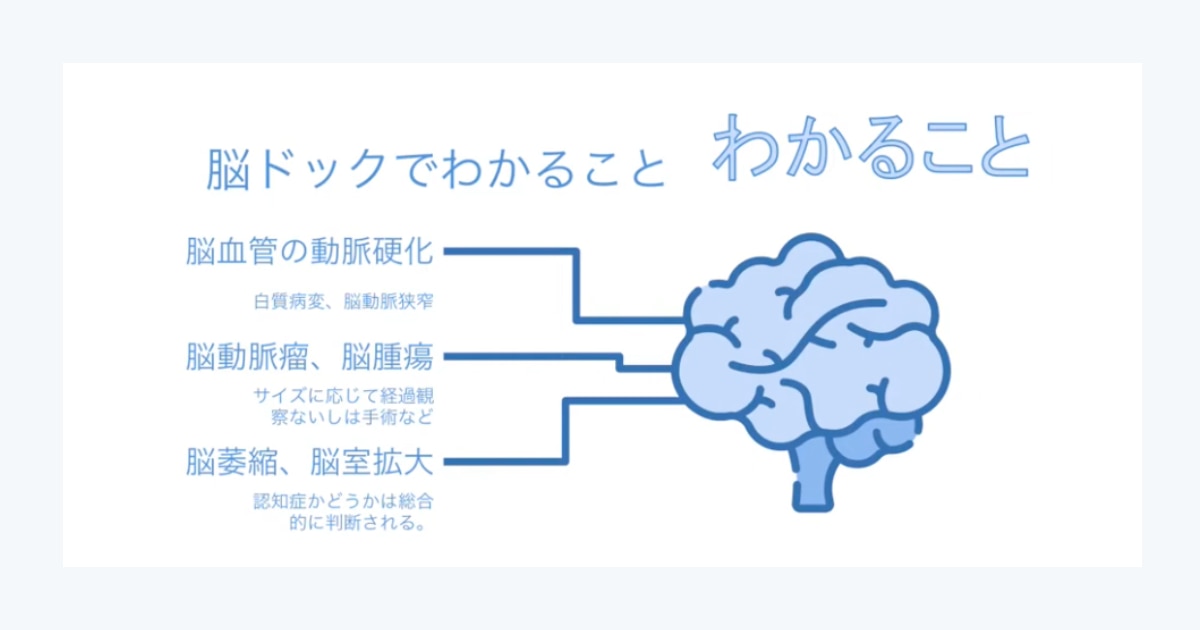 脳ドックでわかること