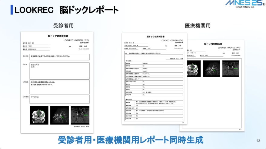 LOOKREC脳ドックレポート