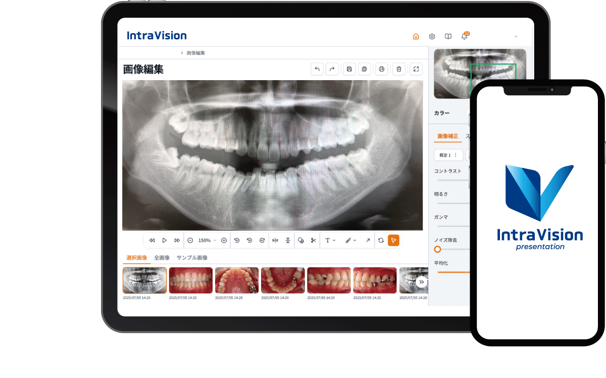 IntraVision(イントラビジョン)
