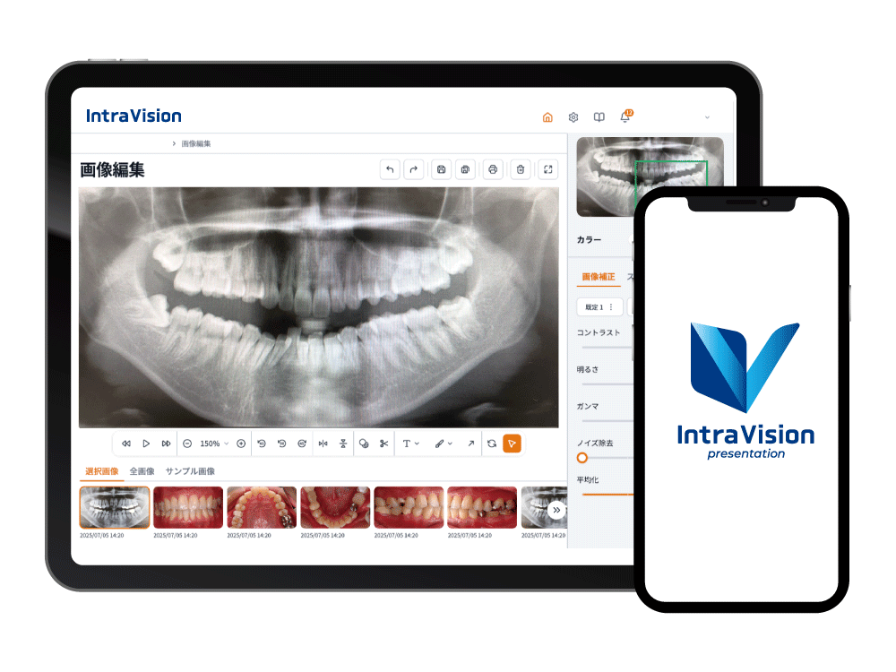 歯科用画像管理・プレゼンツールIntraVision-イントラビジョン-