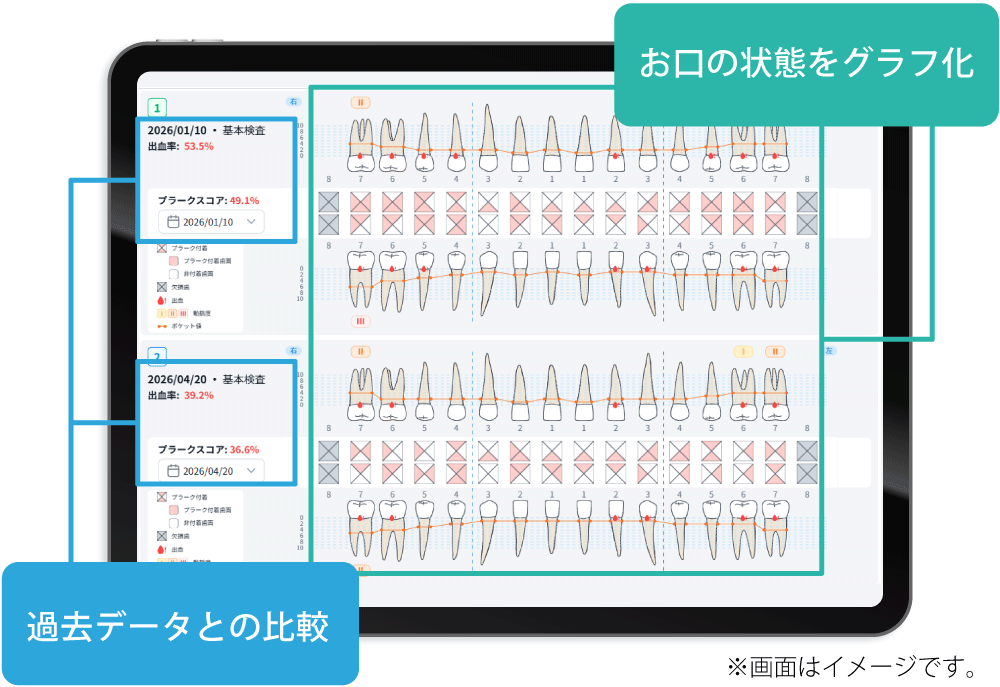 検査結果をグラフで「見える化」患者さんの意識向上をサポート